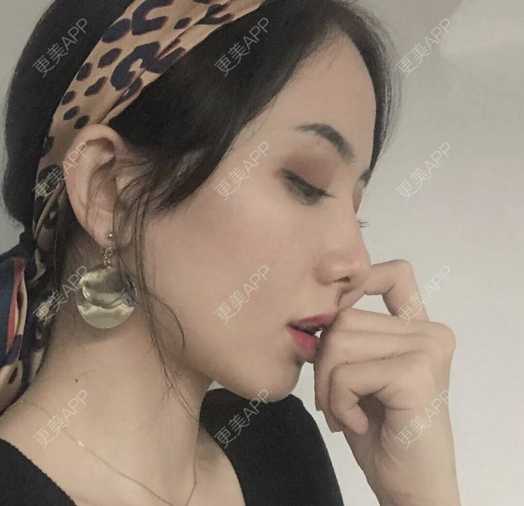 更美 - 珊小姐的鼻部多项经验 | 鼻部多项 | 南昌