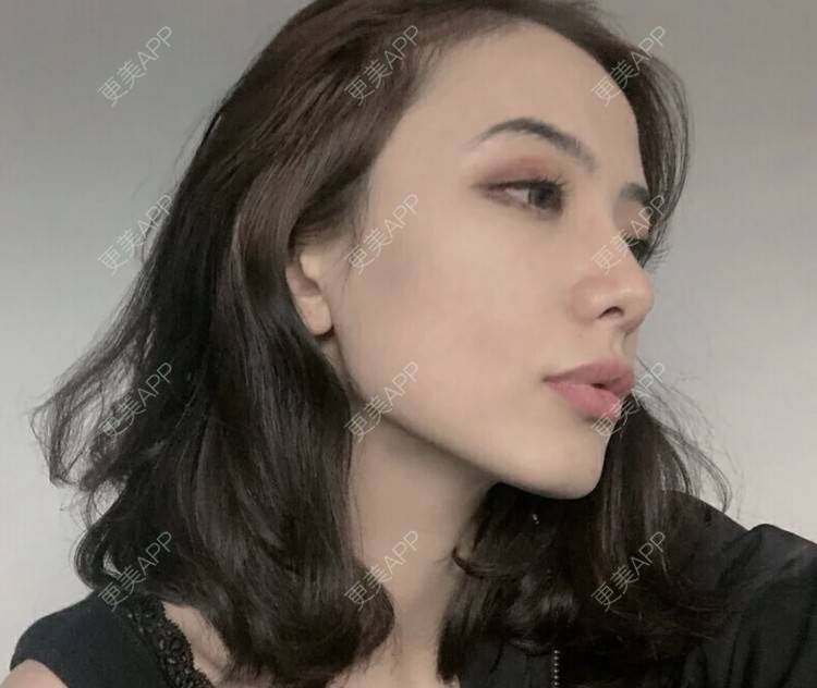 更美 - 珊小姐的鼻部多项经验 | 鼻部多项 | 南昌