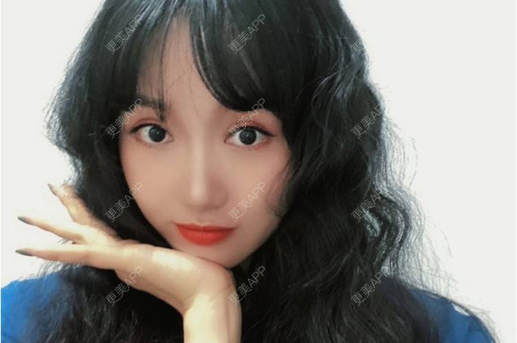 更美 - 努力变美123123的除皱瘦脸经验 | 除皱瘦脸 | 苏州