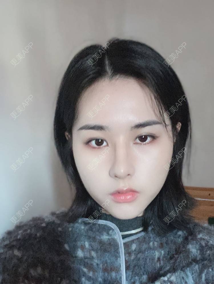 更美 - ヌ酷还可爱ˇ男的鼻部多项经验 | 鼻部多项 | 重庆