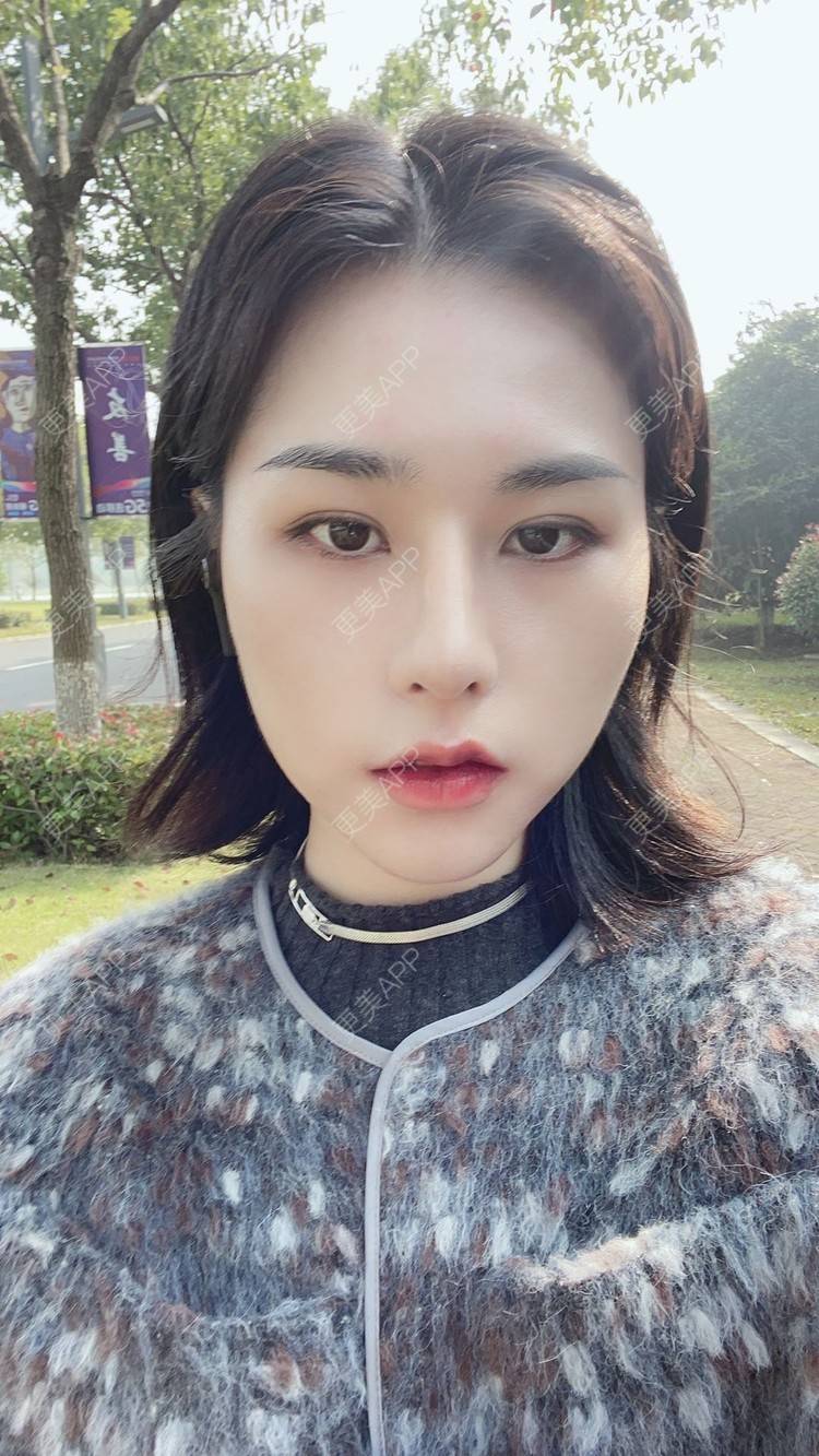 更美 - ヌ酷还可爱ˇ男的鼻部多项经验 | 鼻部多项 | 重庆