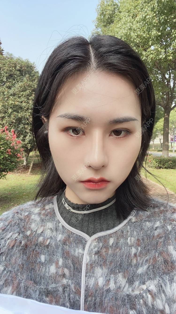 更美 - ヌ酷还可爱ˇ男的鼻部多项经验 | 鼻部多项 | 重庆