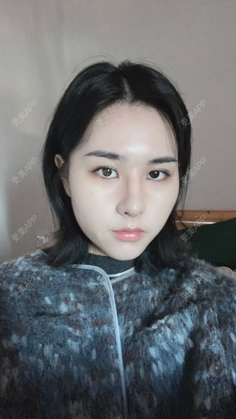 更美 - ヌ酷还可爱ˇ男的鼻部多项经验 | 鼻部多项 | 重庆