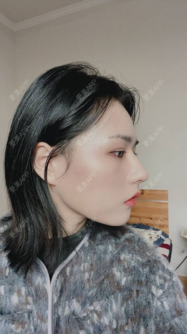 更美 - ヌ酷还可爱ˇ男的鼻部多项经验 | 鼻部多项 | 重庆