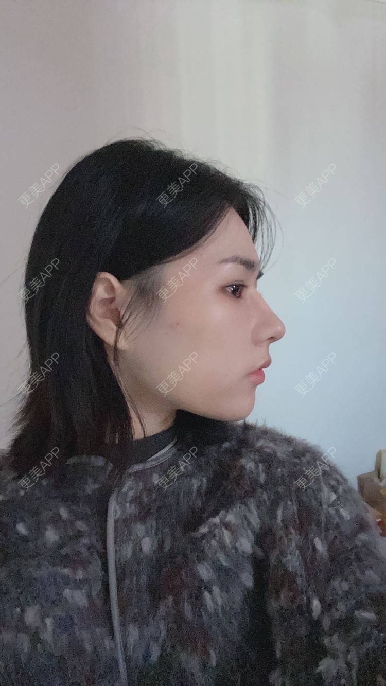 更美 - ヌ酷还可爱ˇ男的鼻部多项经验 | 鼻部多项 | 重庆