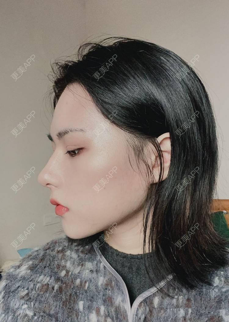 更美 - ヌ酷还可爱ˇ男的鼻部多项经验 | 鼻部多项 | 重庆