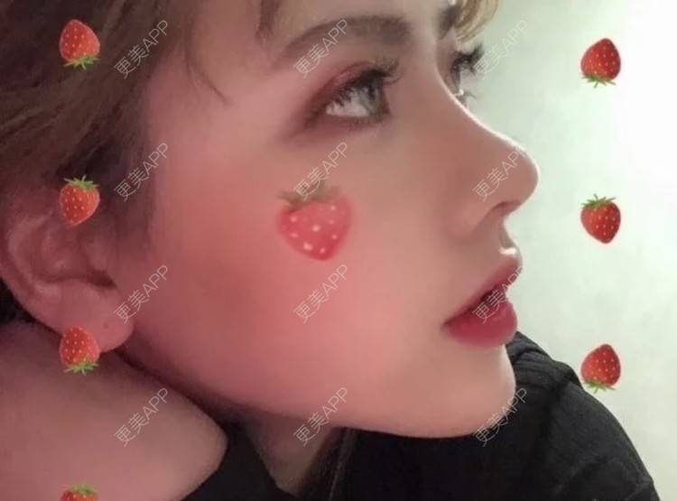 更美 - 知心人哟的鼻部多项经验 | 鼻部多项 | 南昌