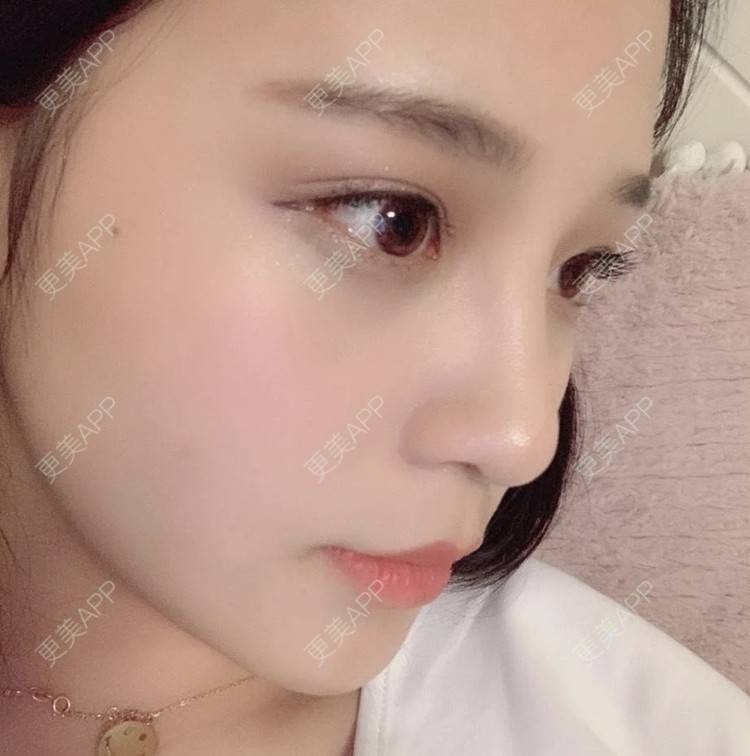 更美 - 托比昂的鼻部多项经验 | 鼻部多项 | 南昌