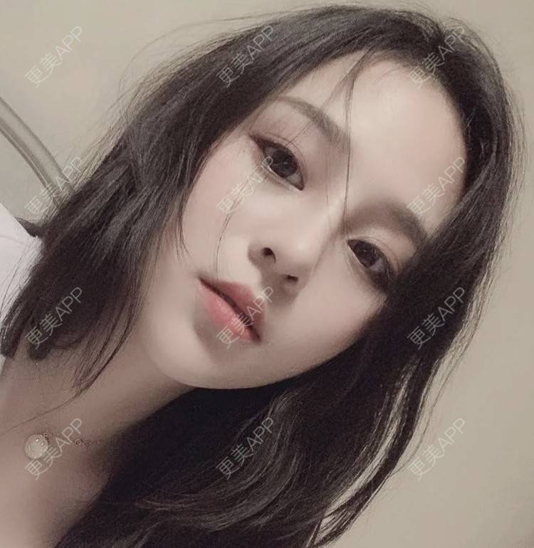 更美 - 托比昂的鼻部多项经验 | 鼻部多项 | 南昌