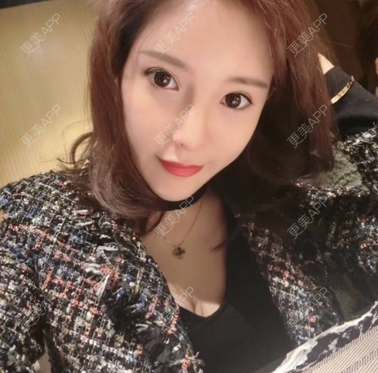 更美 - 托比昂的鼻部多项经验 | 鼻部多项 | 南昌