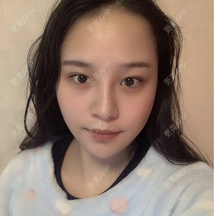 更美 - 托比昂的鼻部多项经验 | 鼻部多项 | 南昌