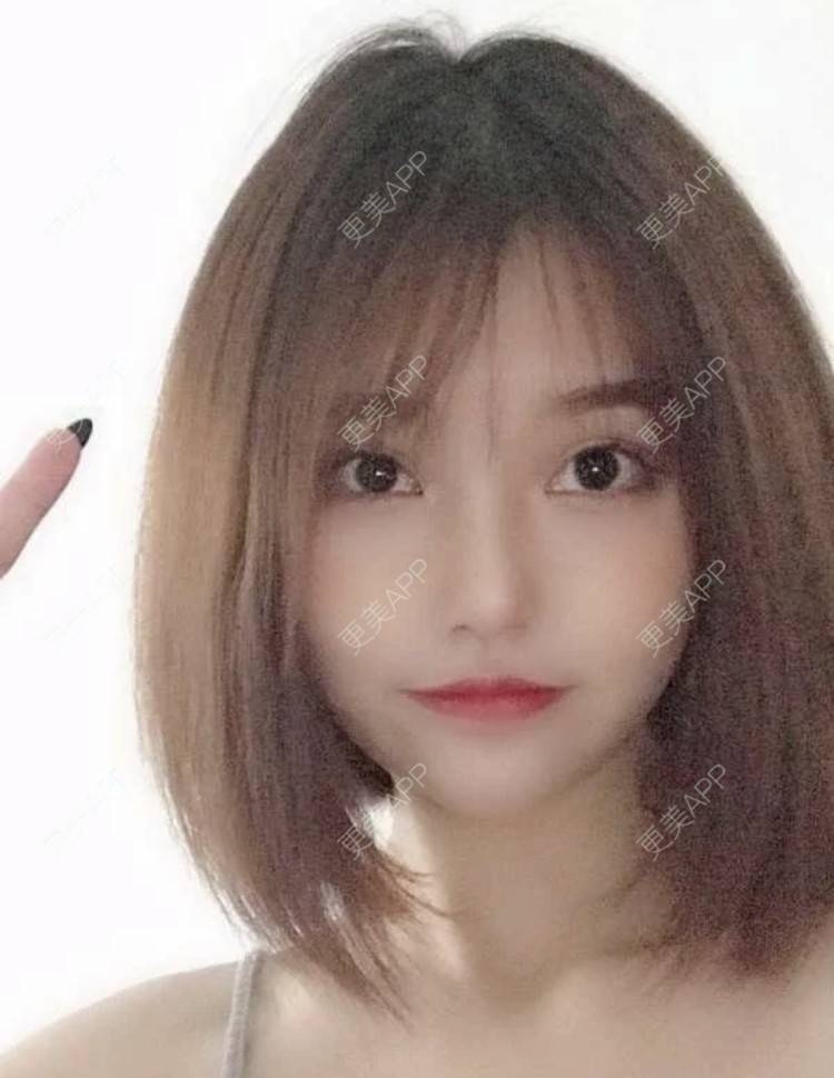 更美 - 雪梨小迷妹的鼻部多项经验 | 鼻部多项 | 南昌