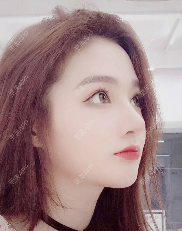 更美 - 乐乐mini的鼻部多项经验 | 鼻部多项 | 南昌