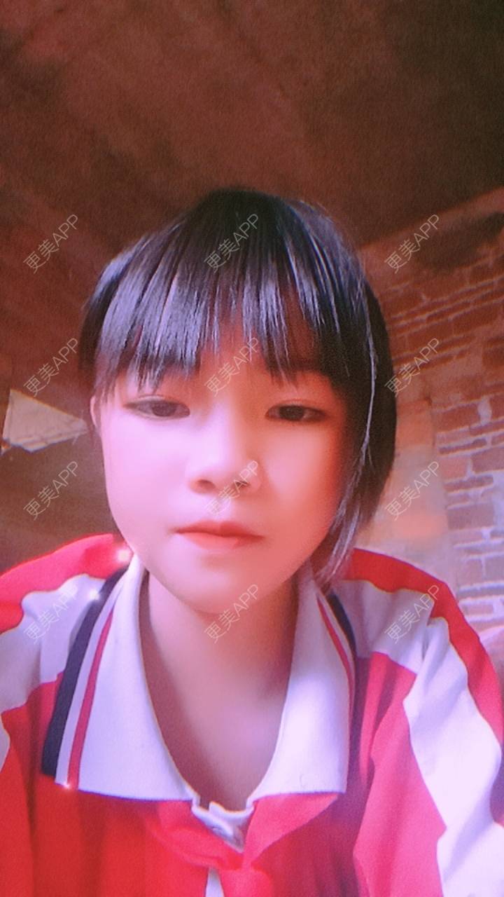 更美 - 更美用户TMlUaju9rh的胶原蛋白丰臀经验 | 胶原蛋白丰臀 | 产后熏蒸