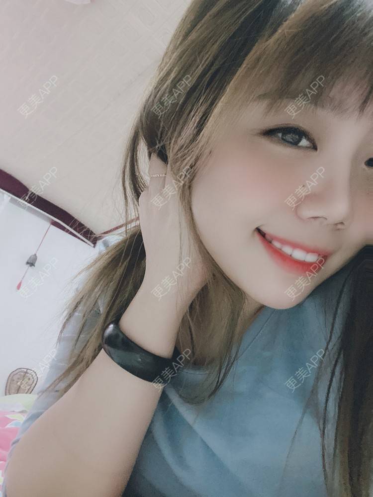 更美 - 更美用户xeNNAZTiuN的除皱瘦脸经验 | 除皱瘦脸 | 自体脂肪垫下巴 | 上海