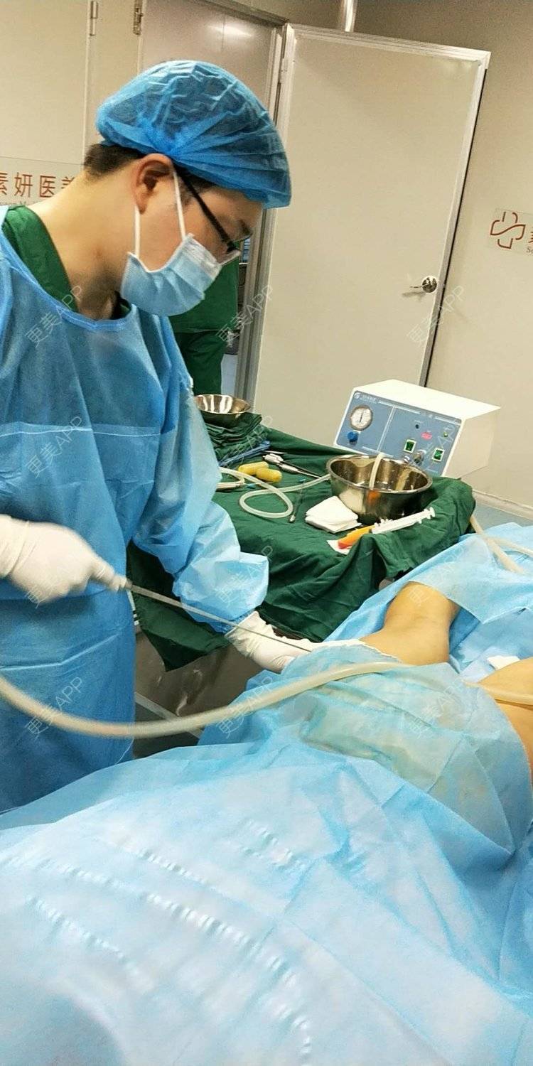 更美用户4b0xo8pu6d的全身吸脂日记