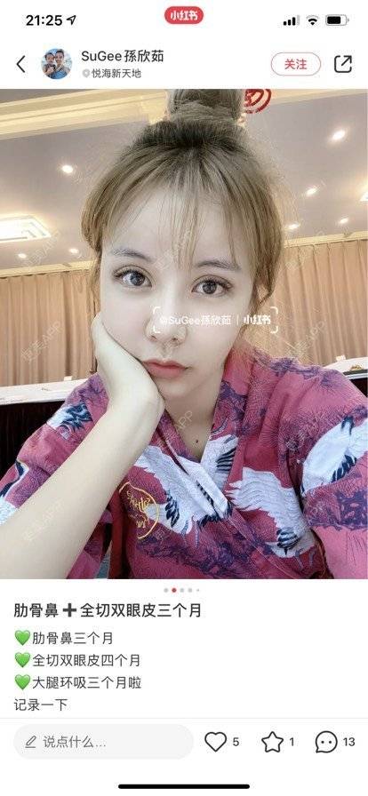 更美 - 更美用户IklpvsWHkC的除皱瘦脸经验 | 除皱瘦脸 | 南京