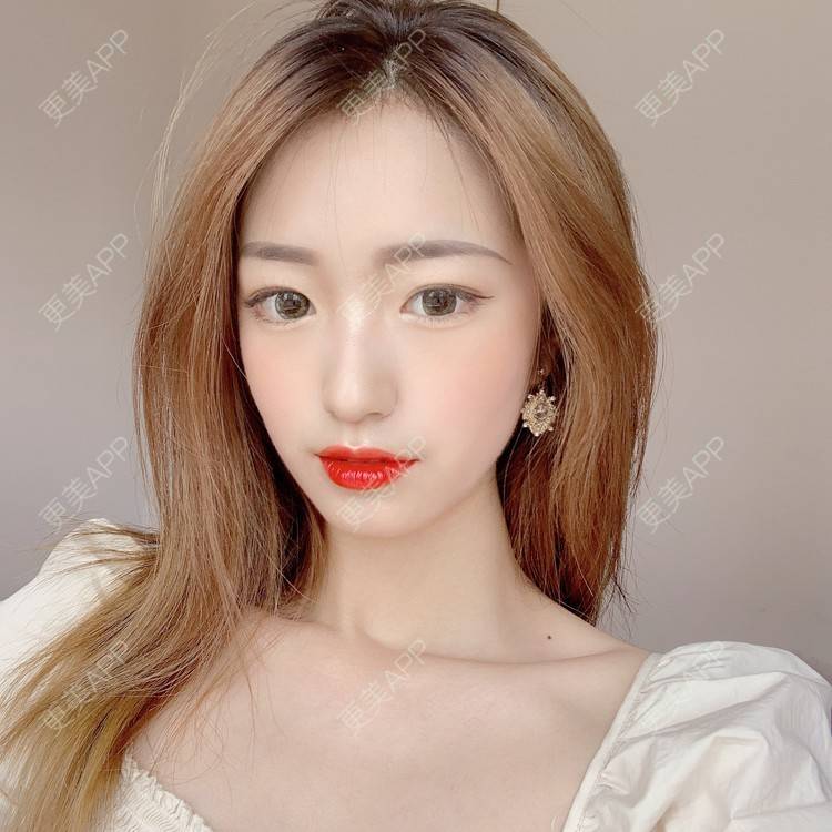 更美 - 更美用户u6yR61K4a7的综合淡疤经验 | 综合淡疤 | 北京