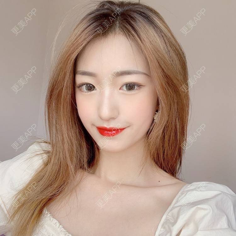 更美 - 更美用户u6yR61K4a7的综合淡疤经验 | 综合淡疤 | 北京
