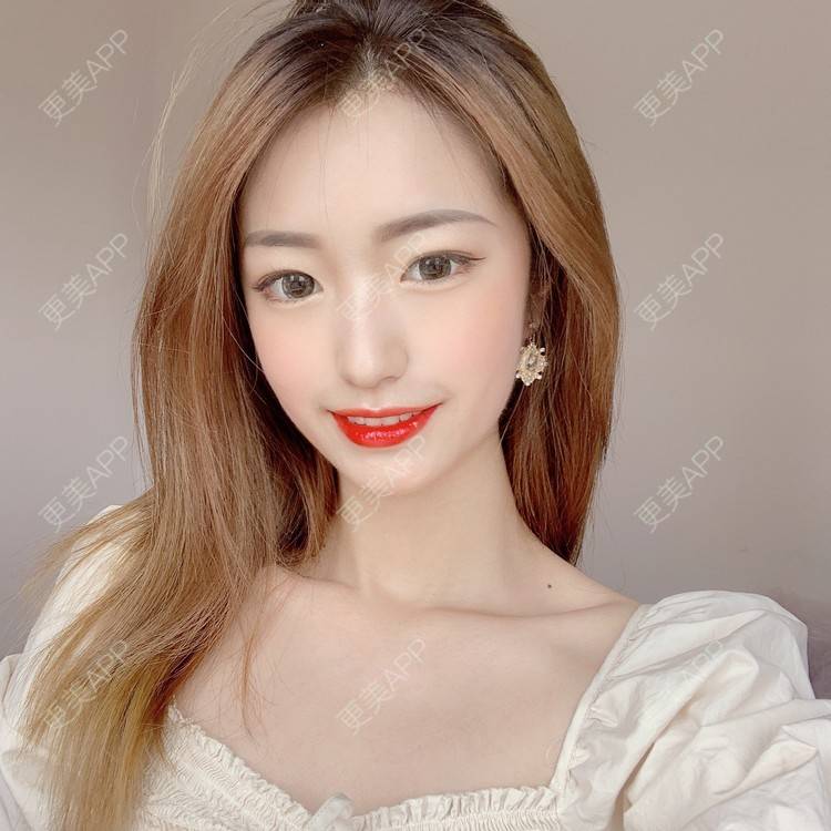 更美 - 更美用户u6yR61K4a7的综合淡疤经验 | 综合淡疤 | 北京