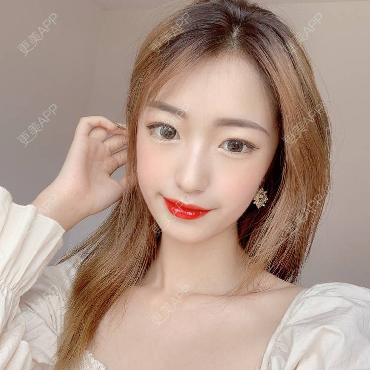 更美 - 更美用户u6yR61K4a7的综合淡疤经验 | 综合淡疤 | 北京