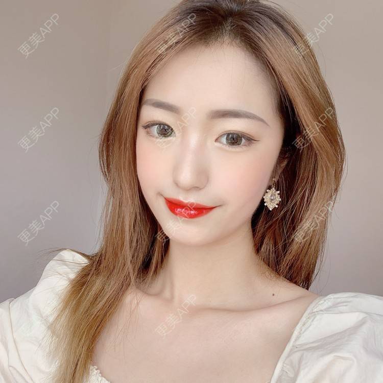 更美 - 更美用户u6yR61K4a7的综合淡疤经验 | 综合淡疤 | 北京
