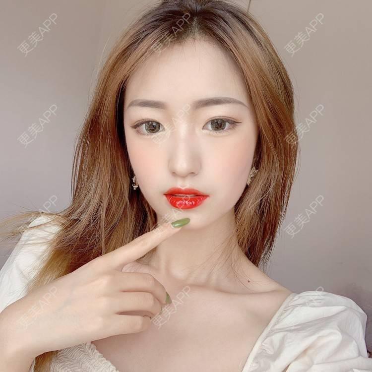 更美 - 更美用户u6yR61K4a7的综合淡疤经验 | 综合淡疤 | 北京