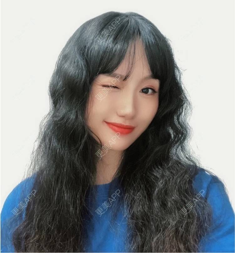 更美 - 努力变美123123的除皱瘦脸经验 | 除皱瘦脸 | 苏州