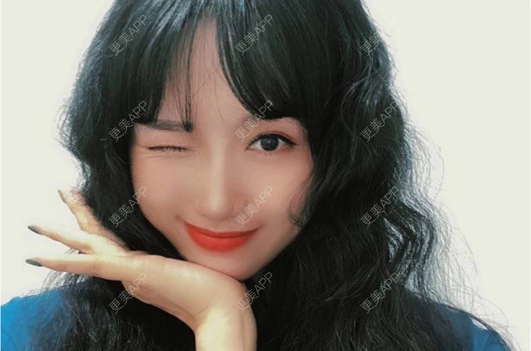 更美 - 努力变美123123的除皱瘦脸经验 | 除皱瘦脸 | 苏州