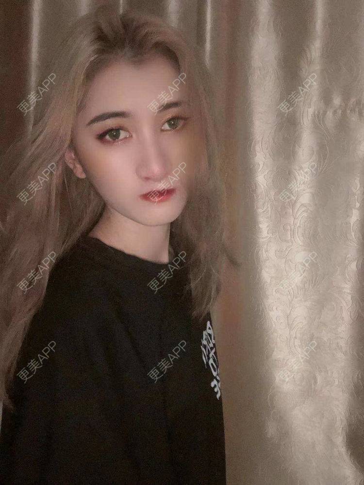 更美 - 最美的期待i的鼻形态修复经验 | 广州 | 鼻形态修复