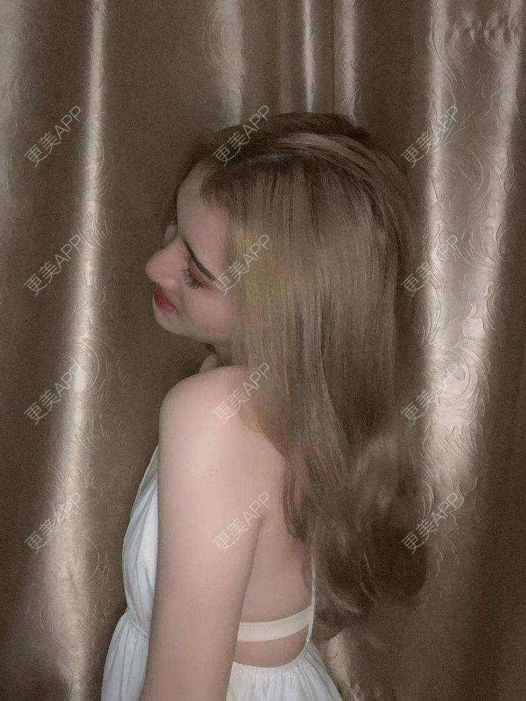 更美 - 最美的期待i的鼻形态修复经验 | 广州 | 鼻形态修复