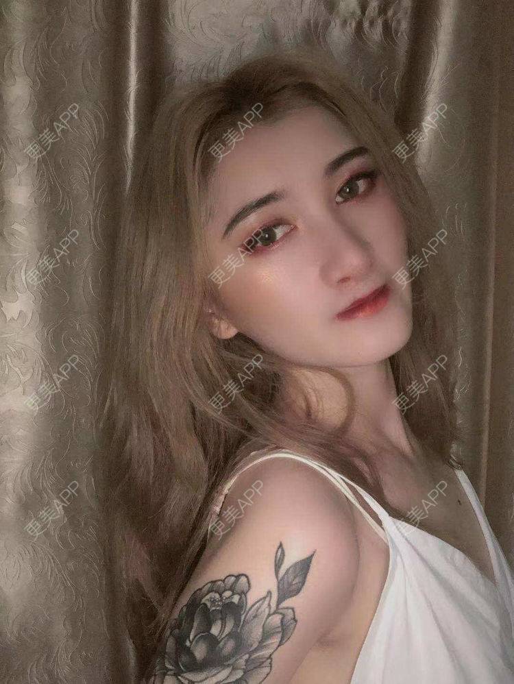 更美 - 最美的期待i的鼻形态修复经验 | 广州 | 鼻形态修复