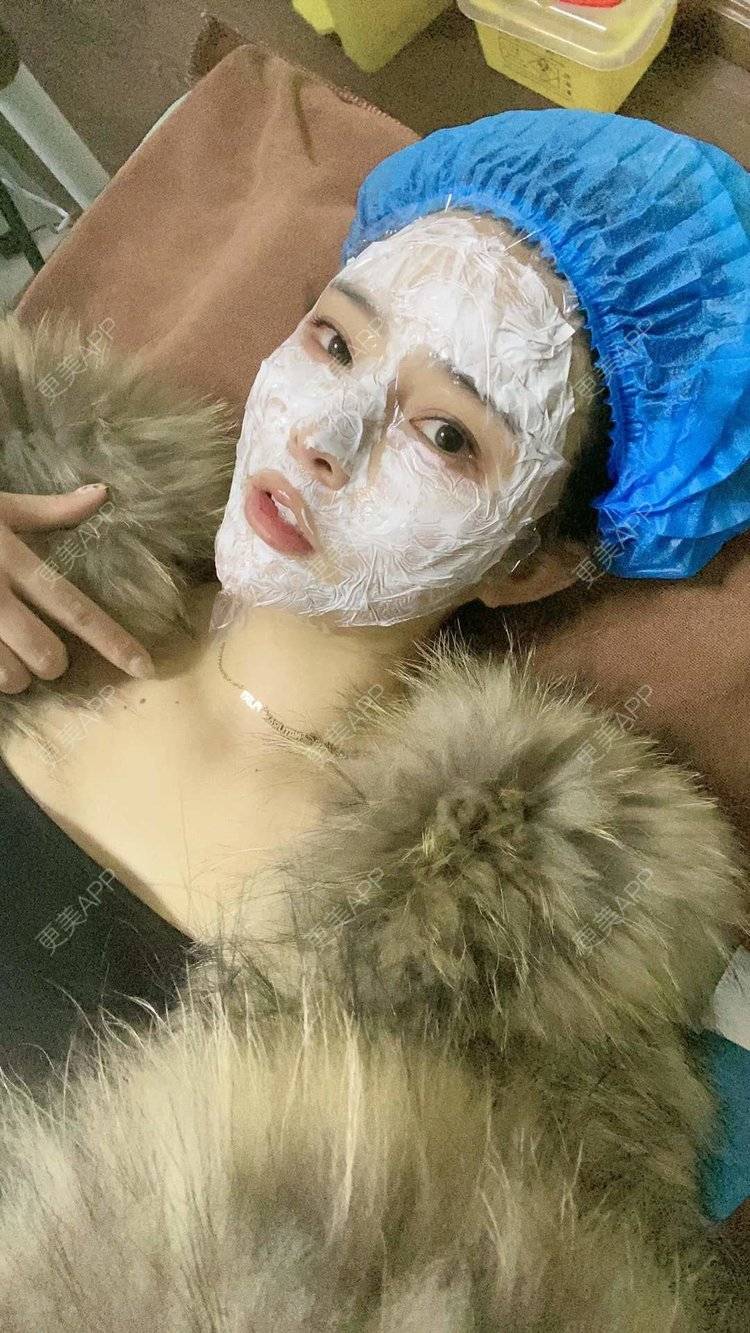 更美 - 大CC阿姨的肋软骨隆鼻经验 | 成都 | 肋软骨隆鼻 | 视频日记