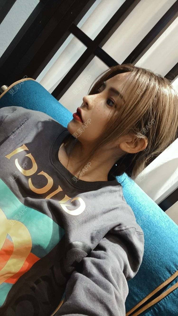 更美 - 大CC阿姨的肋软骨隆鼻经验 | 成都 | 肋软骨隆鼻 | 视频日记