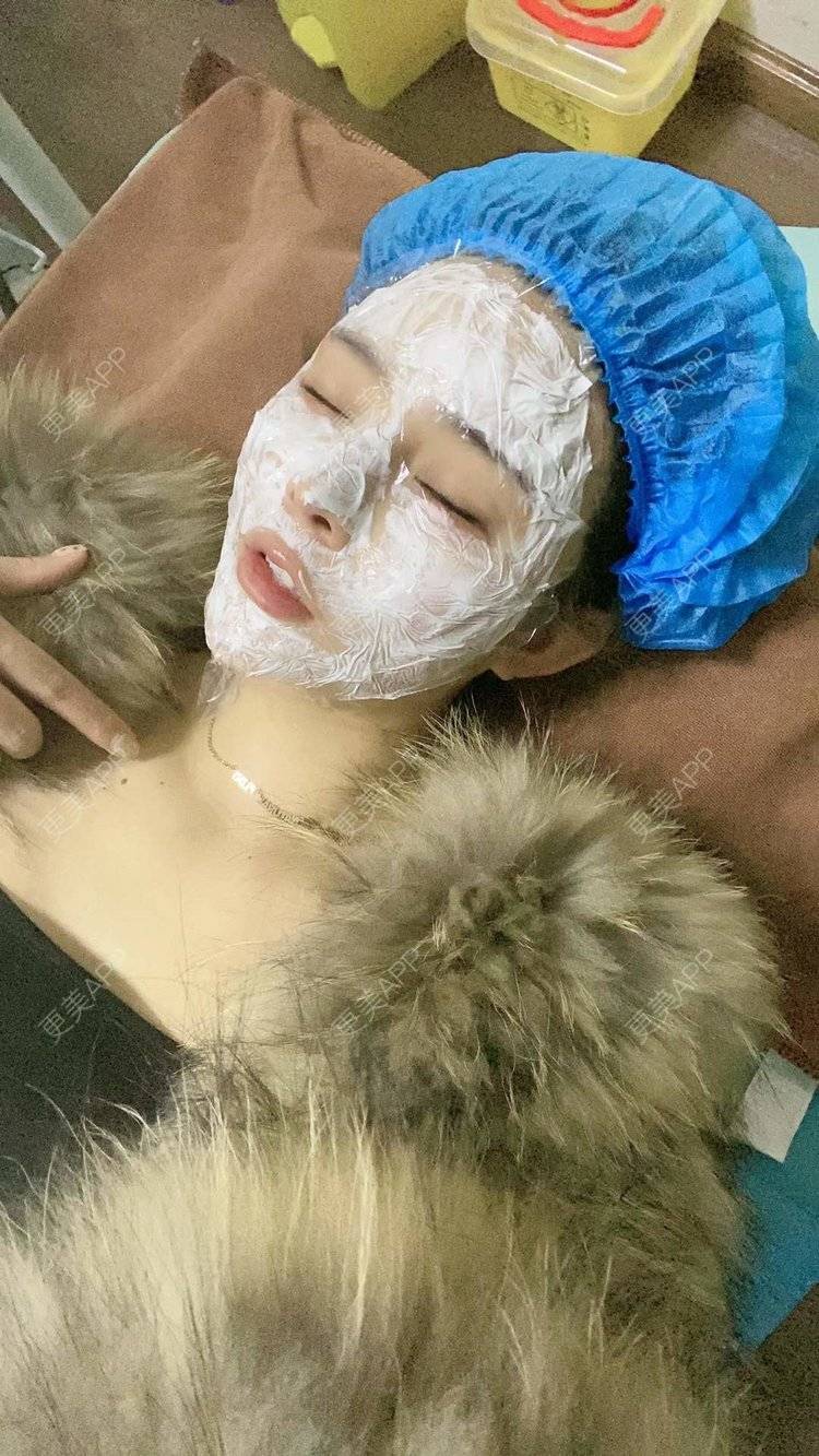 更美 - 大CC阿姨的肋软骨隆鼻经验 | 成都 | 肋软骨隆鼻 | 视频日记