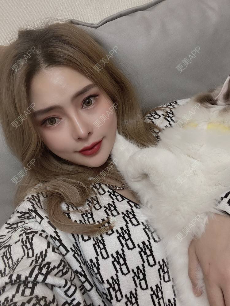 更美 - 大CC阿姨的肋软骨隆鼻经验 | 成都 | 肋软骨隆鼻 | 视频日记