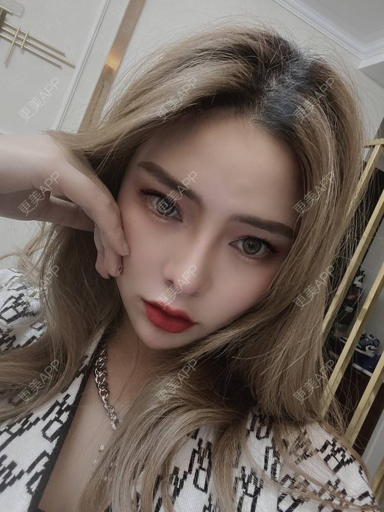 更美 - 大CC阿姨的肋软骨隆鼻经验 | 成都 | 肋软骨隆鼻 | 视频日记