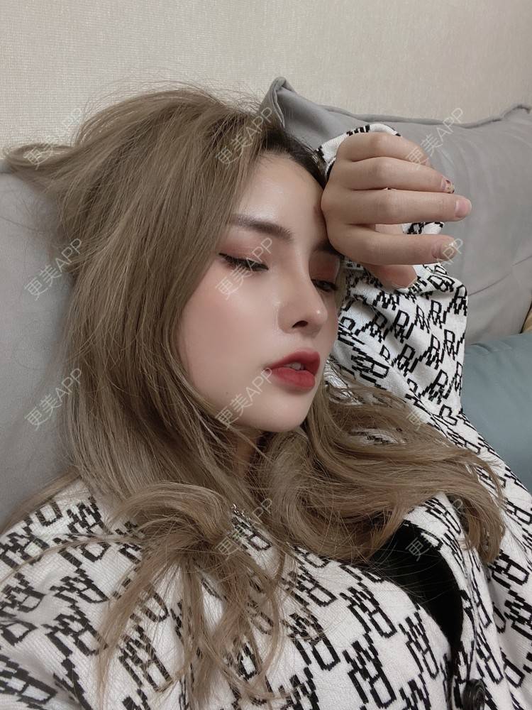 更美 - 大CC阿姨的肋软骨隆鼻经验 | 成都 | 肋软骨隆鼻 | 视频日记