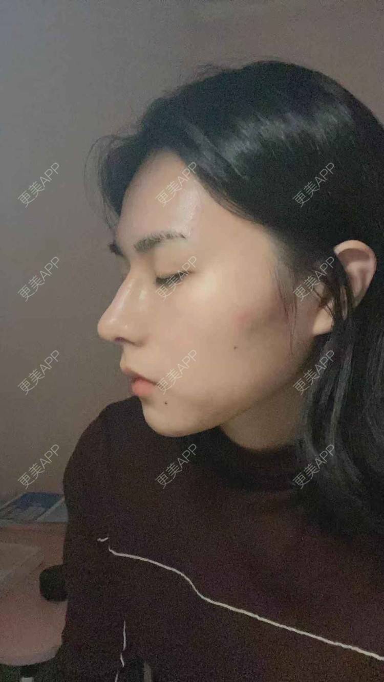 更美 - ヌ酷还可爱ˇ男的鼻部多项经验 | 鼻部多项 | 重庆