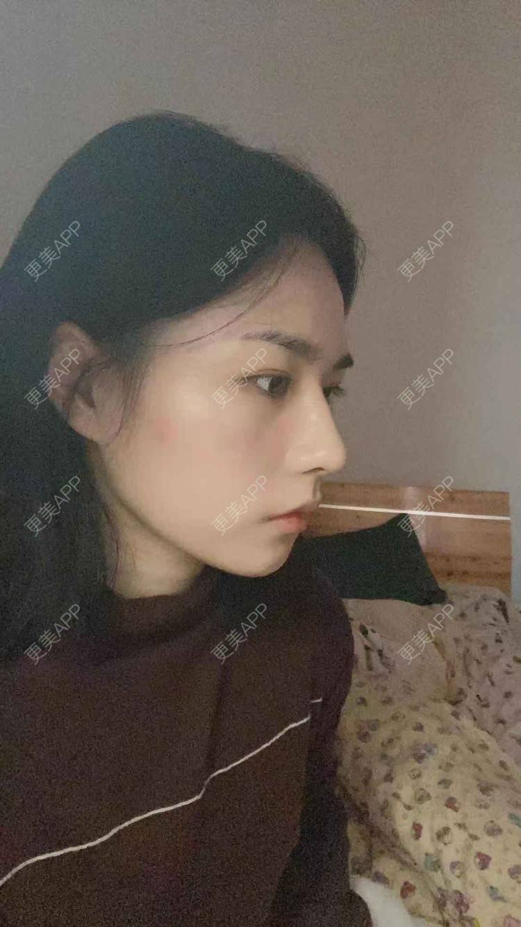 更美 - ヌ酷还可爱ˇ男的鼻部多项经验 | 鼻部多项 | 重庆