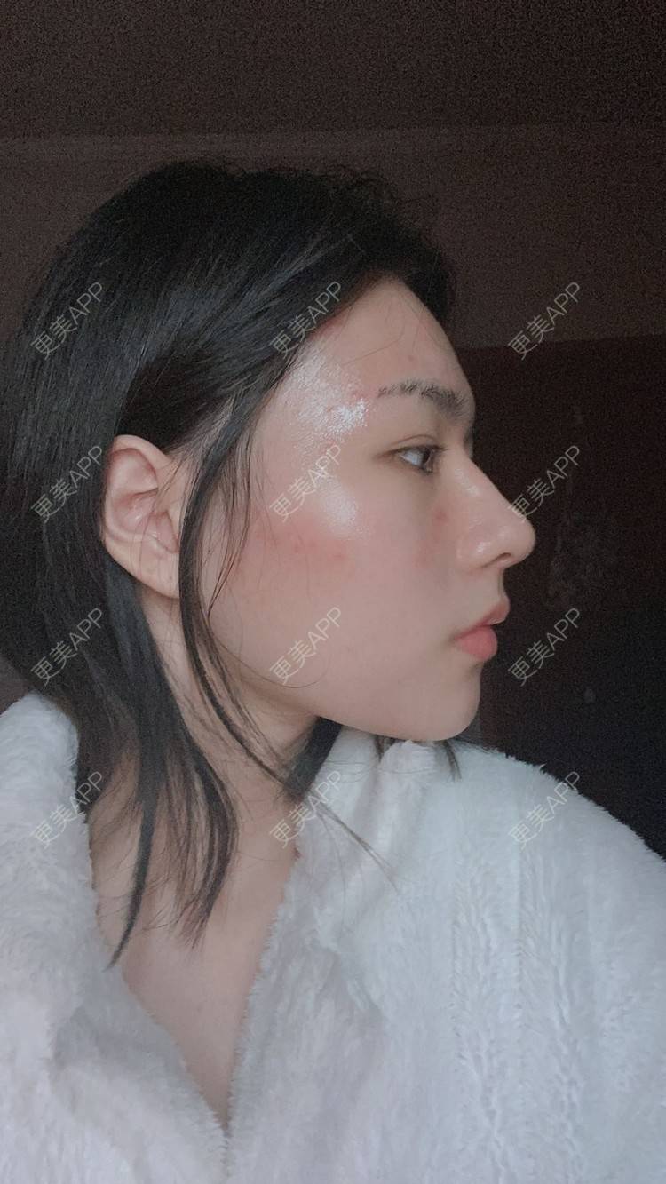 更美 - ヌ酷还可爱ˇ男的鼻部多项经验 | 鼻部多项 | 重庆