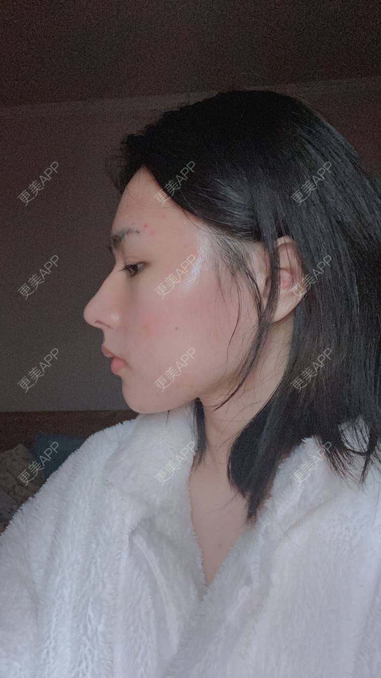 更美 - ヌ酷还可爱ˇ男的鼻部多项经验 | 鼻部多项 | 重庆