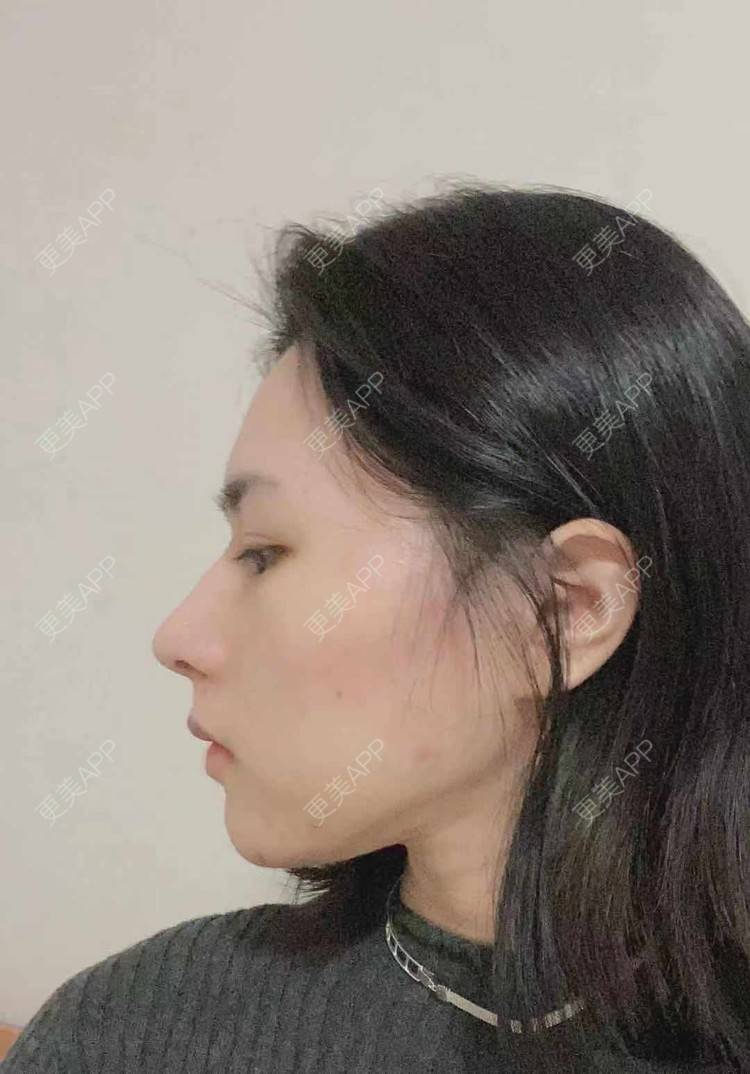 更美 - ヌ酷还可爱ˇ男的鼻部多项经验 | 鼻部多项 | 重庆