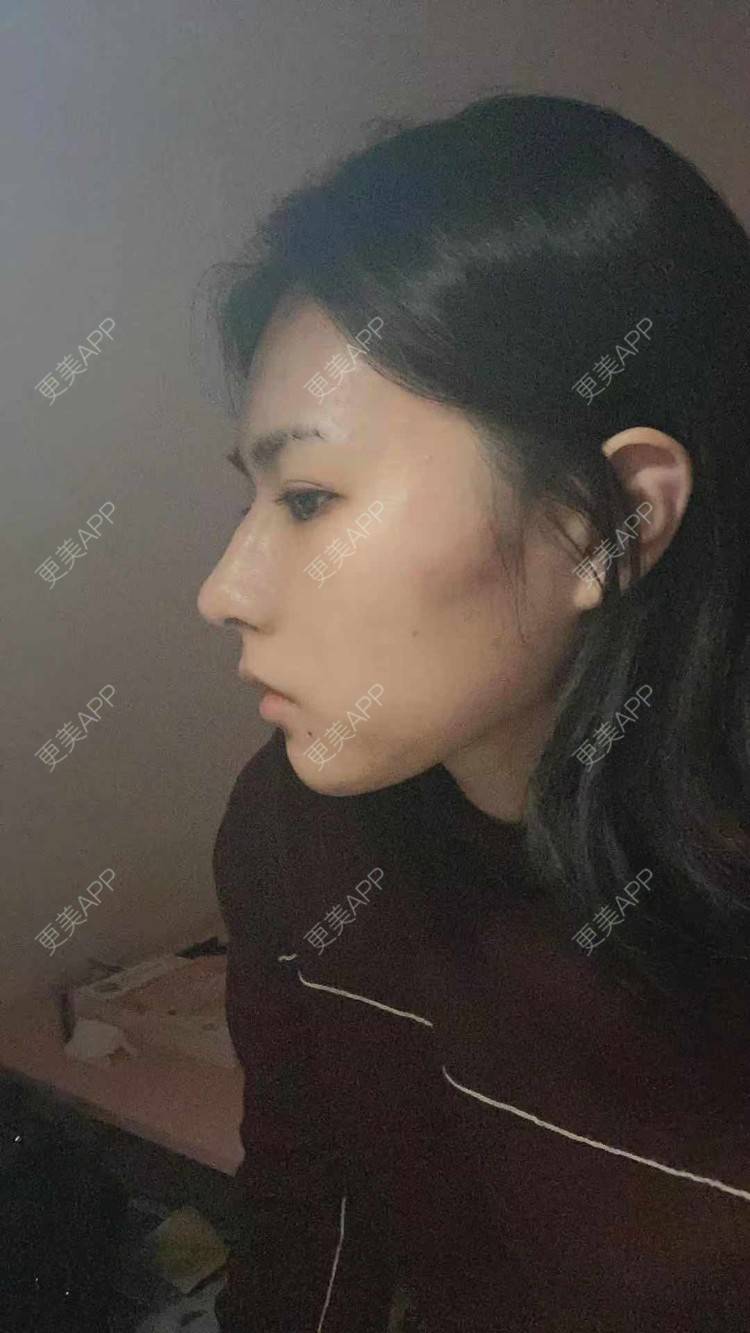 更美 - ヌ酷还可爱ˇ男的鼻部多项经验 | 鼻部多项 | 重庆