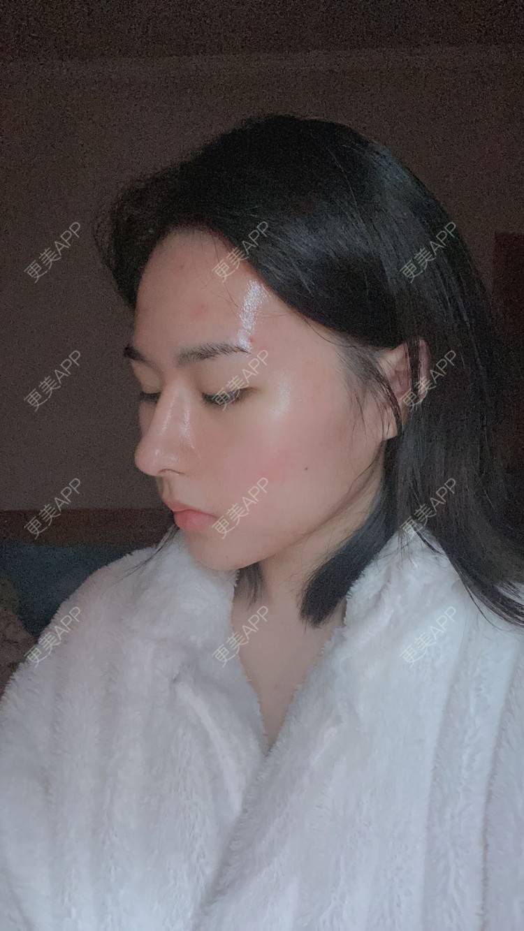 更美 - ヌ酷还可爱ˇ男的鼻部多项经验 | 鼻部多项 | 重庆