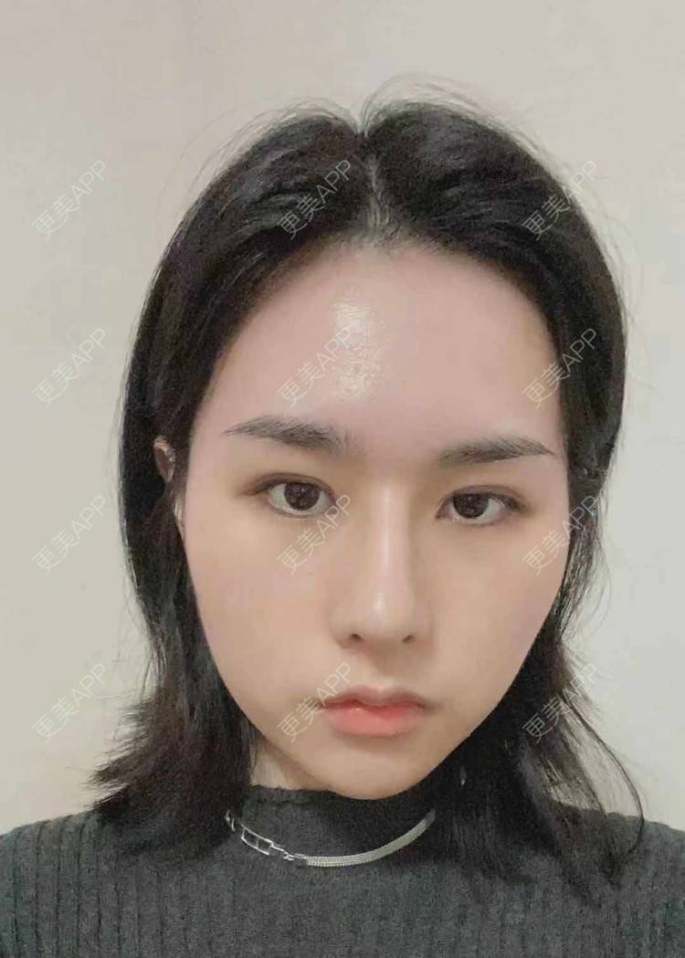 更美 - ヌ酷还可爱ˇ男的鼻部多项经验 | 鼻部多项 | 重庆