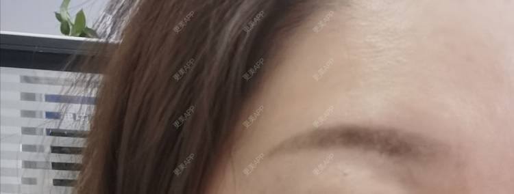 更美 - baoXbao的皮秒激光经验 | 皮秒激光 | 广州