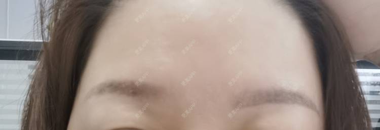 更美 - baoXbao的皮秒激光经验 | 皮秒激光 | 广州