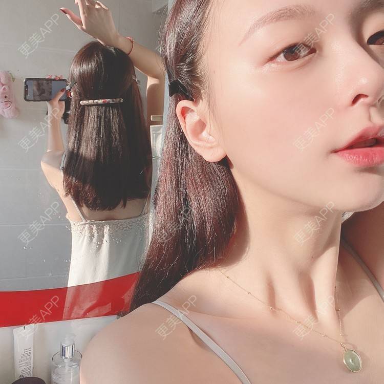 更美 - 更美用户9Nt11KbhXj的自体脂肪全面部填充经验 | 广州 | 自体脂肪全面部填充 | 视频日记