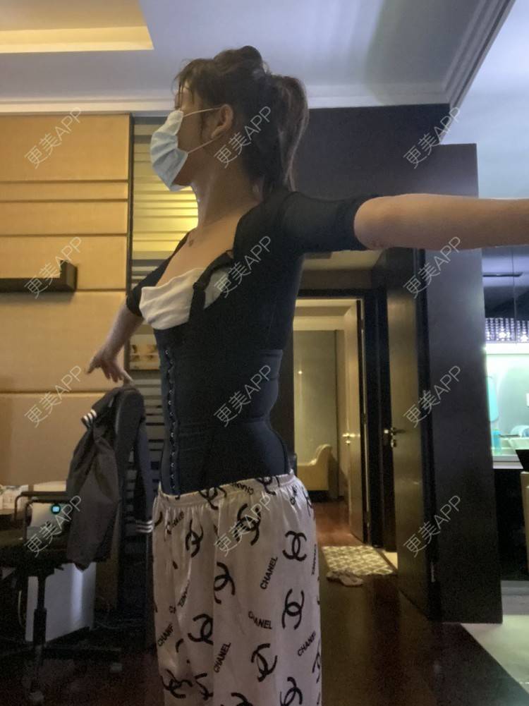 更美 - 更美用户KeZigsBQ7k的射频溶脂瘦手臂经验 | 广州 | 射频溶脂瘦手臂